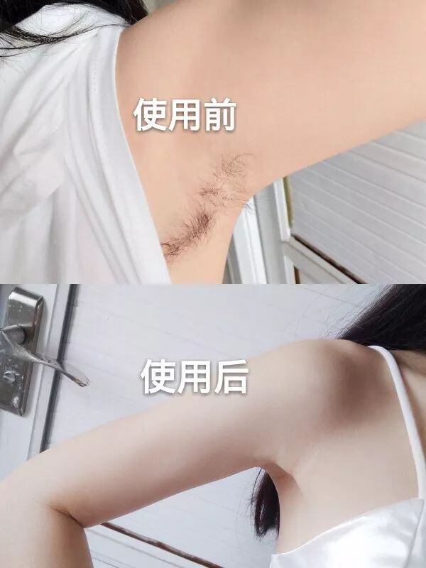 喷一喷,15分钟无痛脱毛,还能抑制体毛生长!无效退款