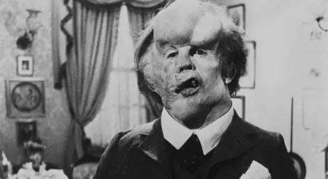 象人的悲惨一生:遭父亲抛弃,为生计不得不被像物品一样展出_梅里克