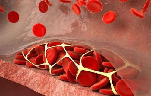 血液粘稠的人,尽量少碰二白,多吃三黄,或许能帮你清理血管垃圾