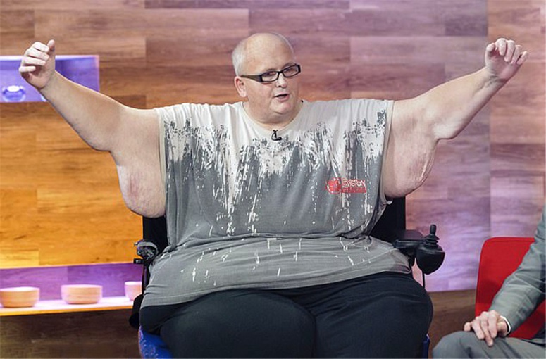 原创世界上最胖的人感情受挫反弹英国纳税人不愿再为其肥胖买单