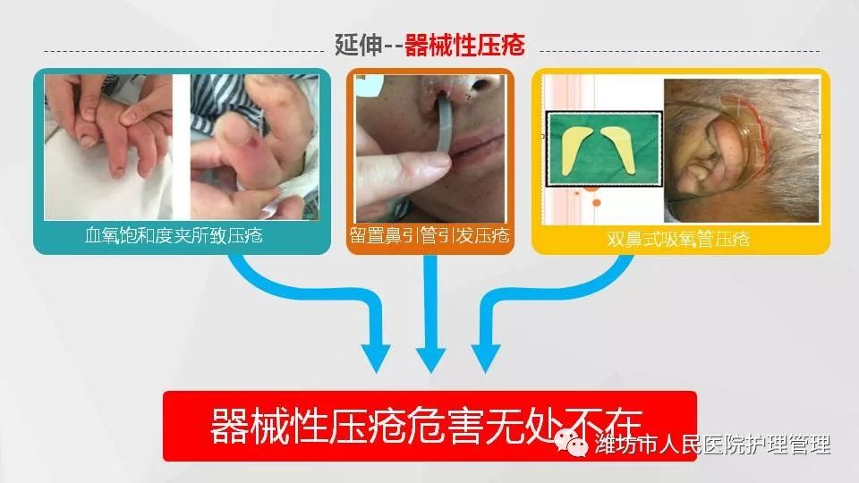 ppt:器械相关性压疮不良事件分享