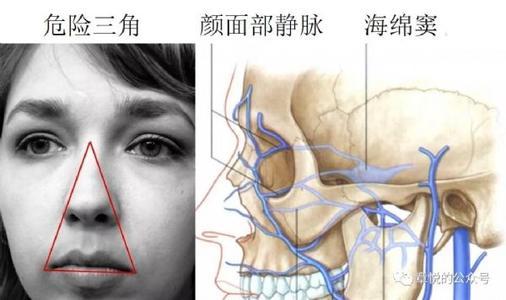 面部危险三角区挤痘痘害你没商量