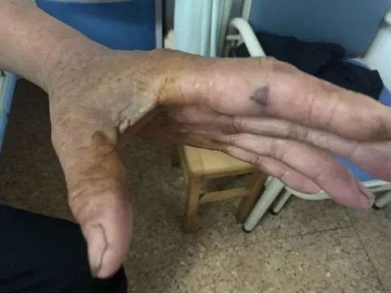 一男子遇眼镜蛇,断掉的蛇头竟然咬人!