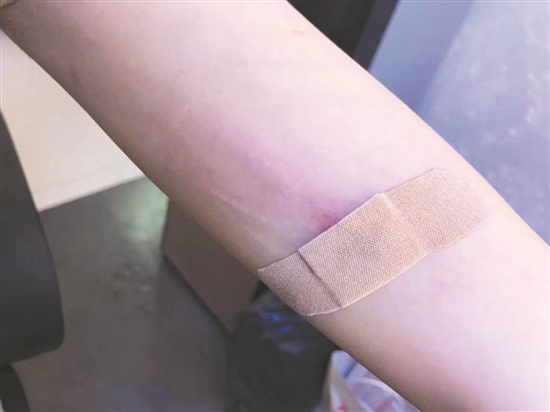 当心微商版埋线避孕正往你的身体里埋雷