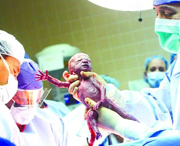 38岁女人2次流产后怀孕,医生却让打掉,宝宝出生吓得医生往后退