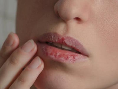 正常人的嘴唇应该红润有光泽,如果嘴唇看起来苍白,没有血色,同时又