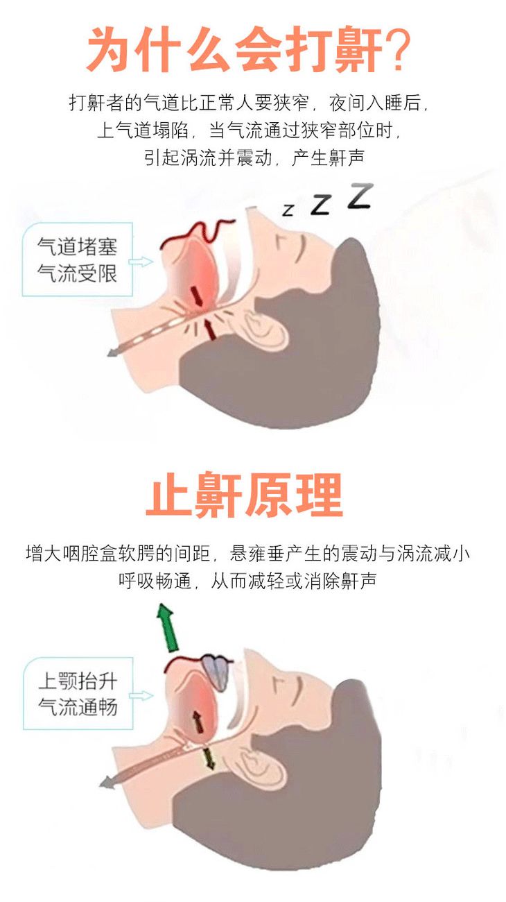 腭垂变长图片