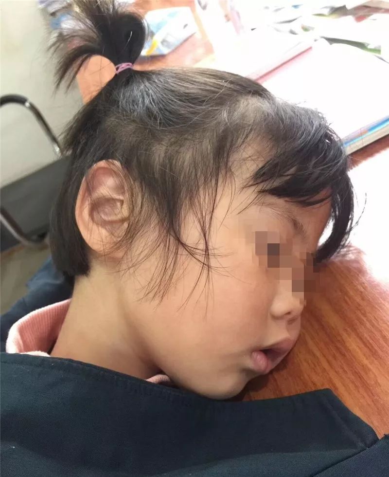 吓人仙游四岁女孩把硬币吞进肚子里