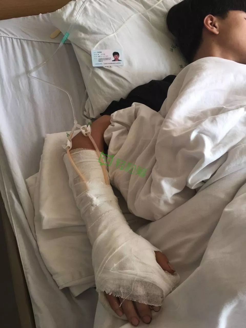 意外澄海16岁少年突发车祸右手被拖行致手筋断裂更让人心酸的是