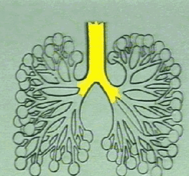 呼吸时肺的变化动态图图片