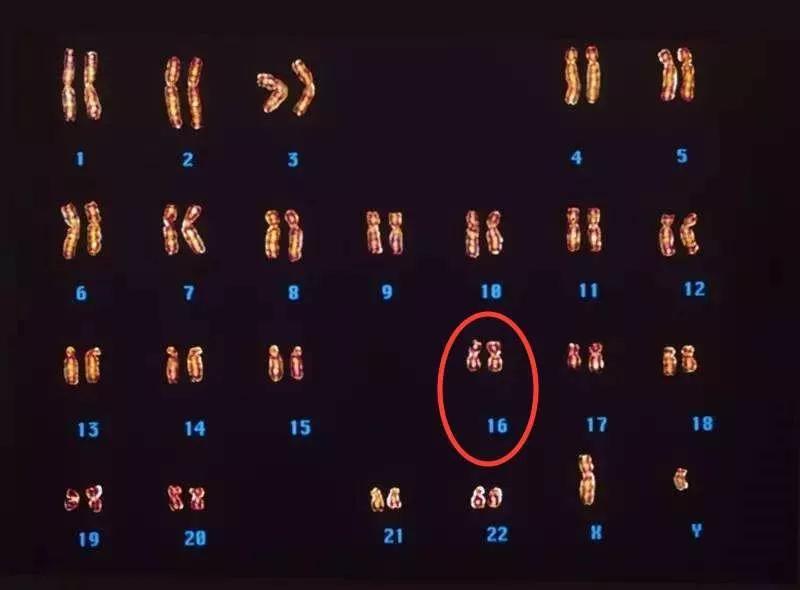 原创狐臭真的和狐狸有关吗