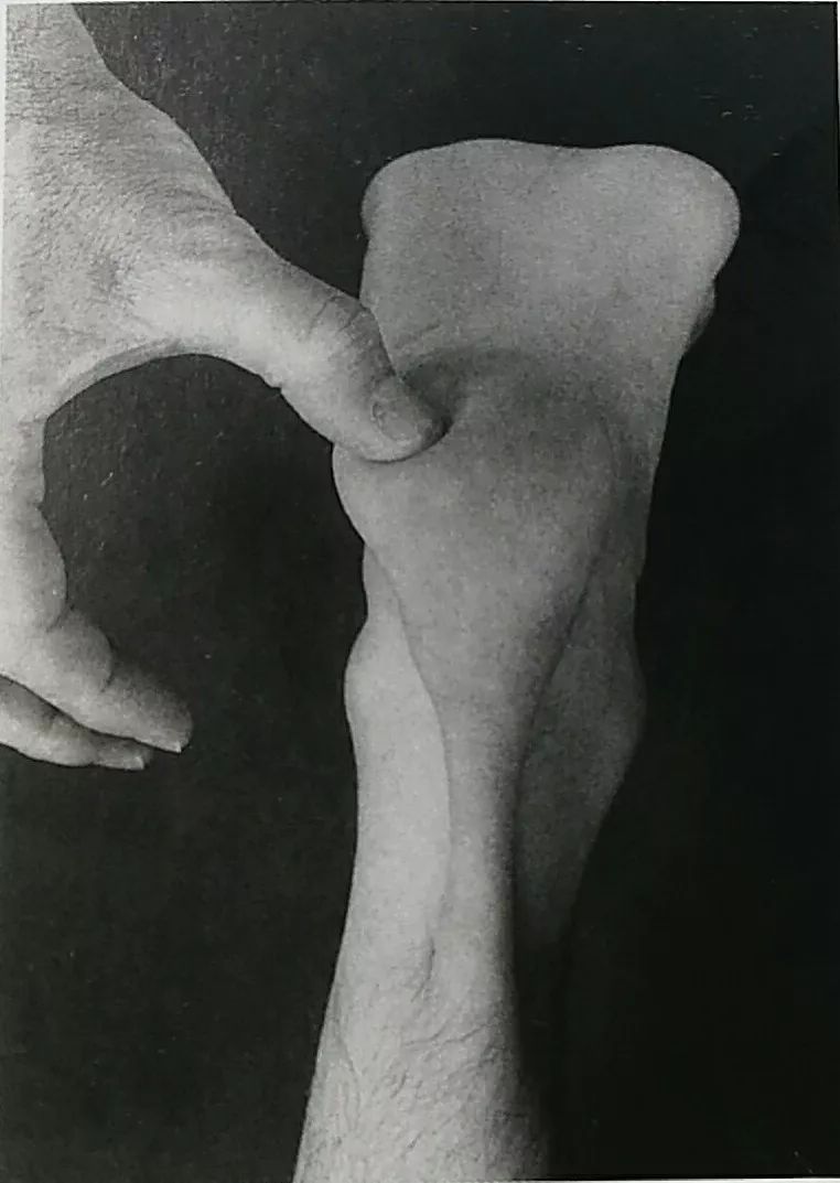 足部跖侧面触诊