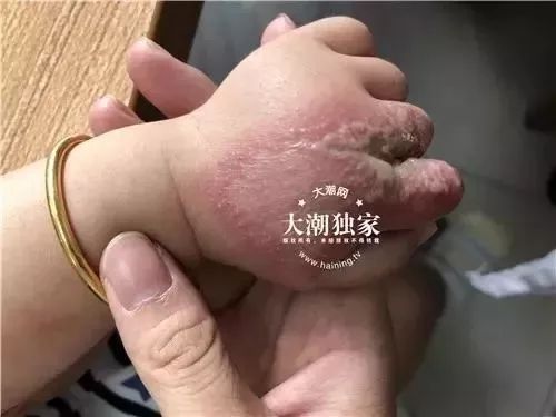 提醒出门散步遇到这种虫千万不要用手打有毒