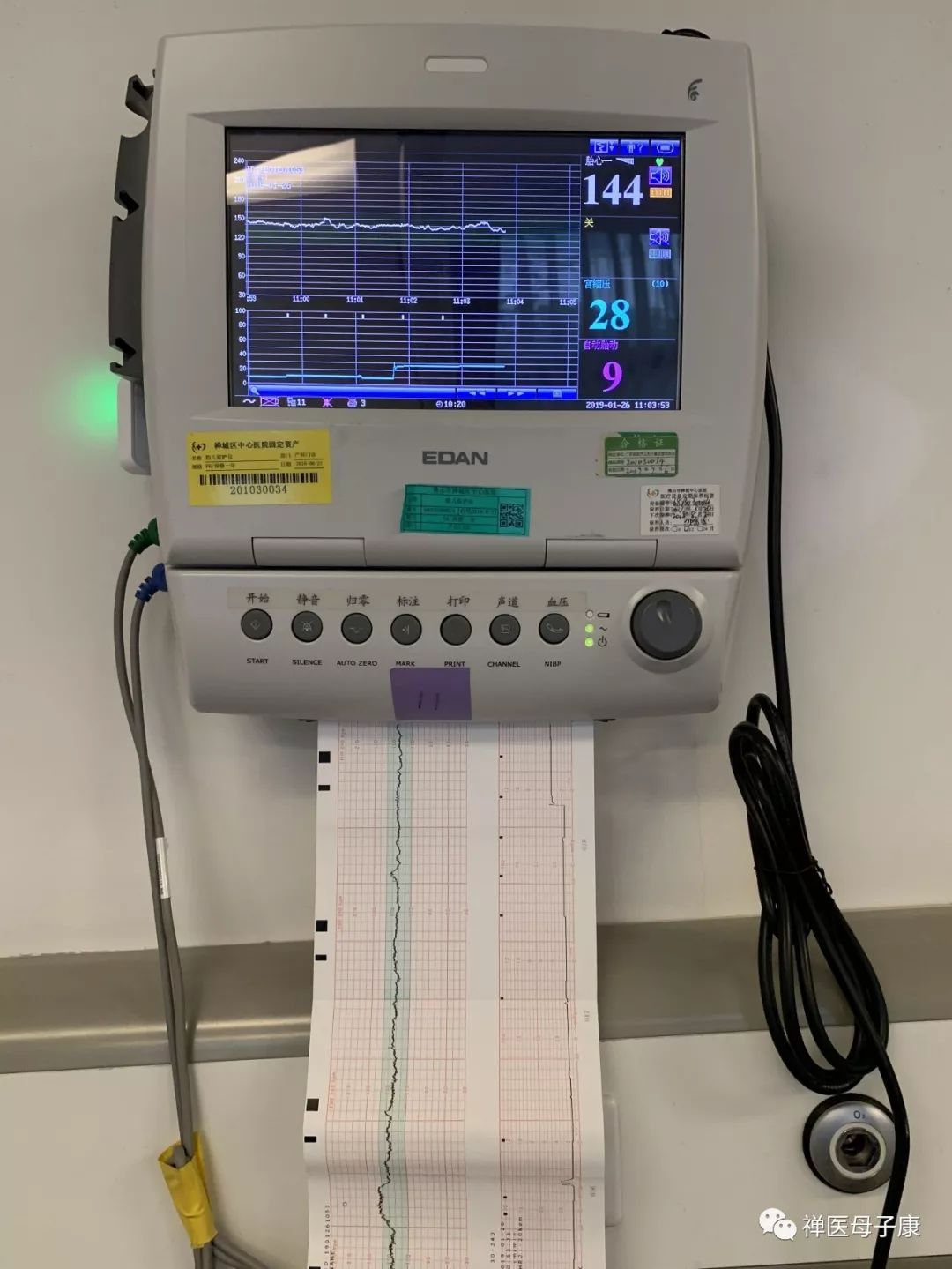 【科普第3期】"胎儿监护"很重要,直接反映胎儿是否健康!