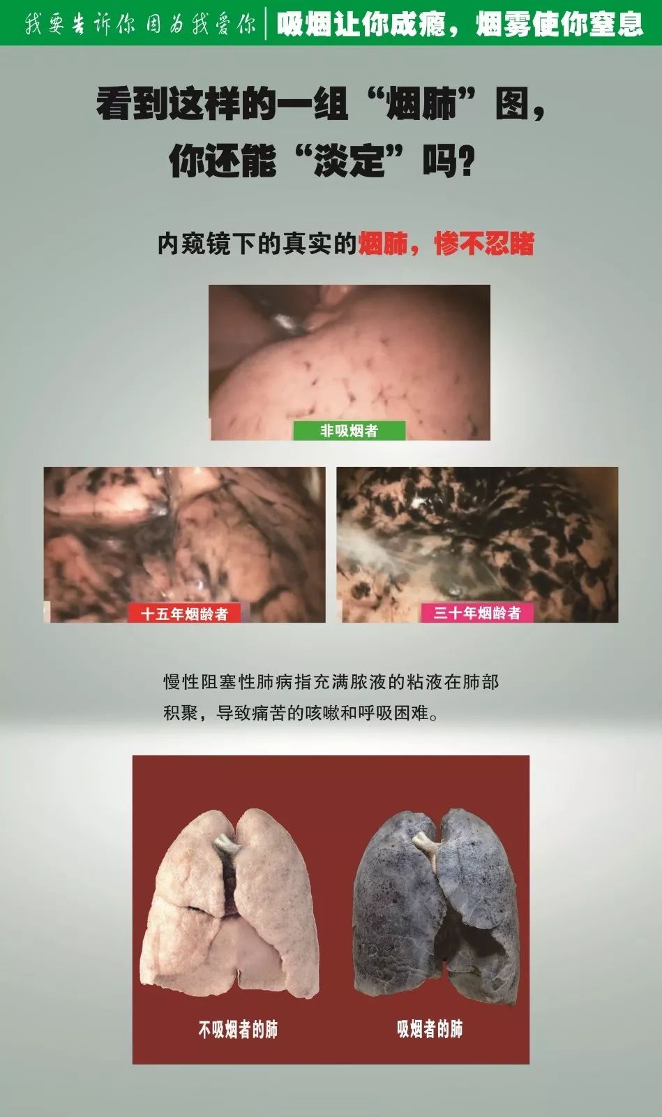 世界无烟日我要告诉你因为我爱你系列第六期烟草伤肺令我心伤展板巡展