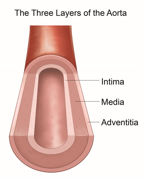 这种病被称为"死亡通知书",出现这些症状请马上就医!_主动脉