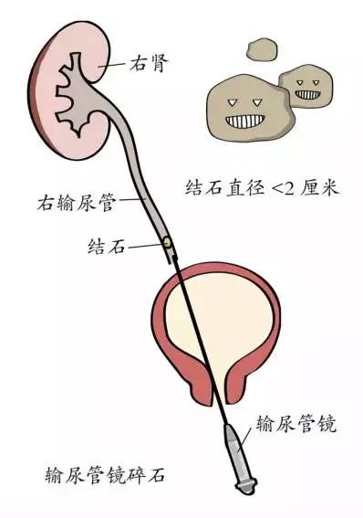 喜讯