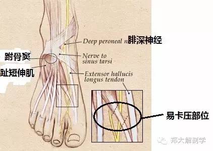 腓总神经解剖/易卡压点/触诊/牵张治疗