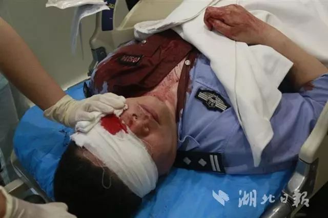 让家人隐瞒 铮铮铁骨,感动一座城 他践行了一个人民警察的庄严承诺!