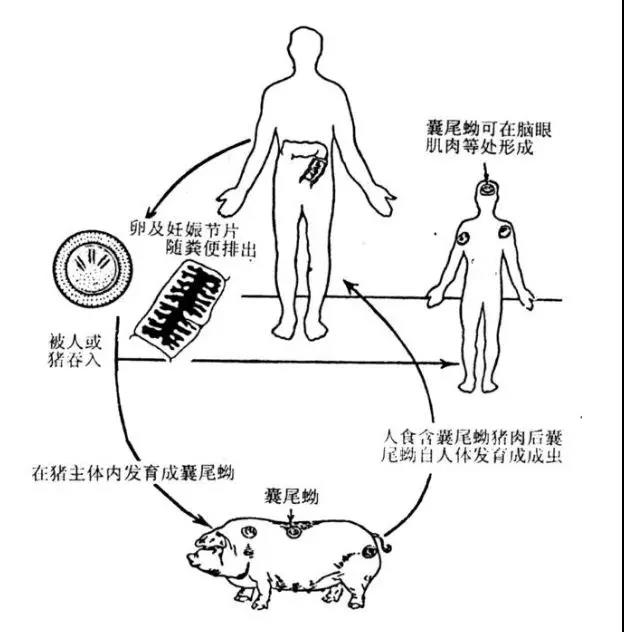 不注意这些,你也可能会脑袋长虫! _囊虫