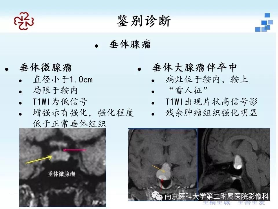 史上最全垂体rathke囊肿的mri诊断与鉴别