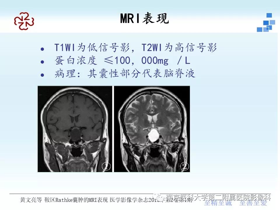 史上最全垂体rathke囊肿的mri诊断与鉴别