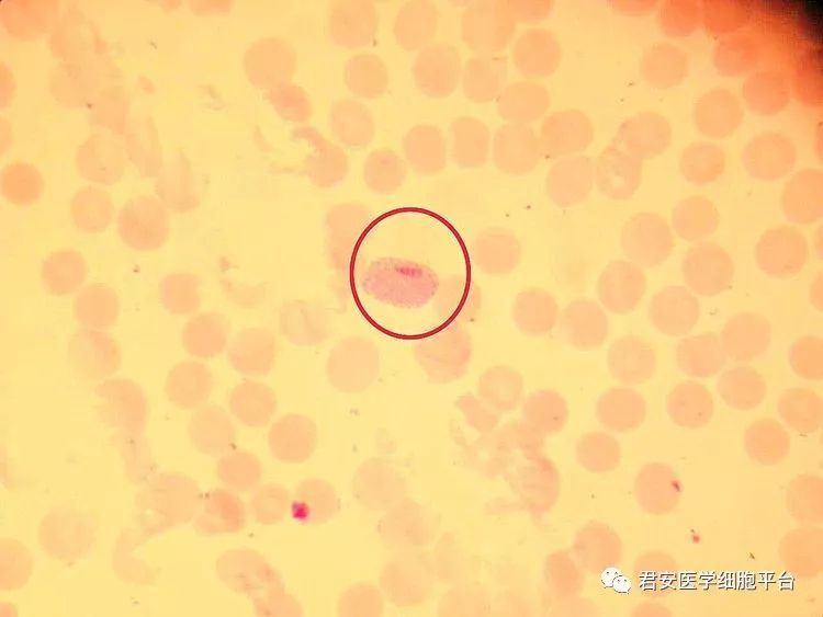 恶性疟原虫雄配子体图片