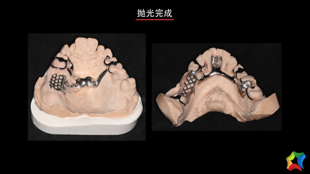 纯钛全口活动义齿图片图片