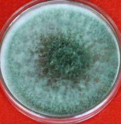 毛霉属毛霉的菌丝体发达,菌落质地疏松,呈棉絮状,由许多分枝的菌丝