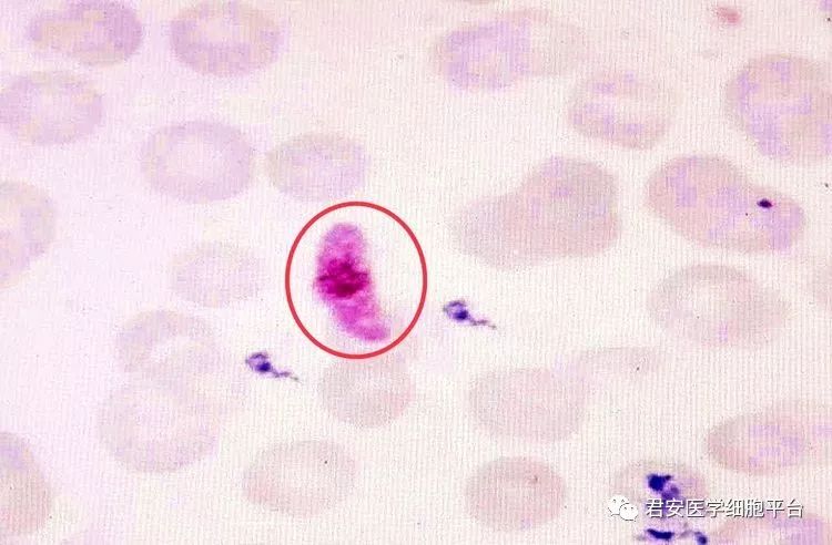 恶性疟原虫雄配子体图片