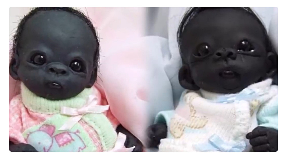 这个孩子比通俗的黑人孩子更黑,连眼白都是黑色的,却由于长相看起来"