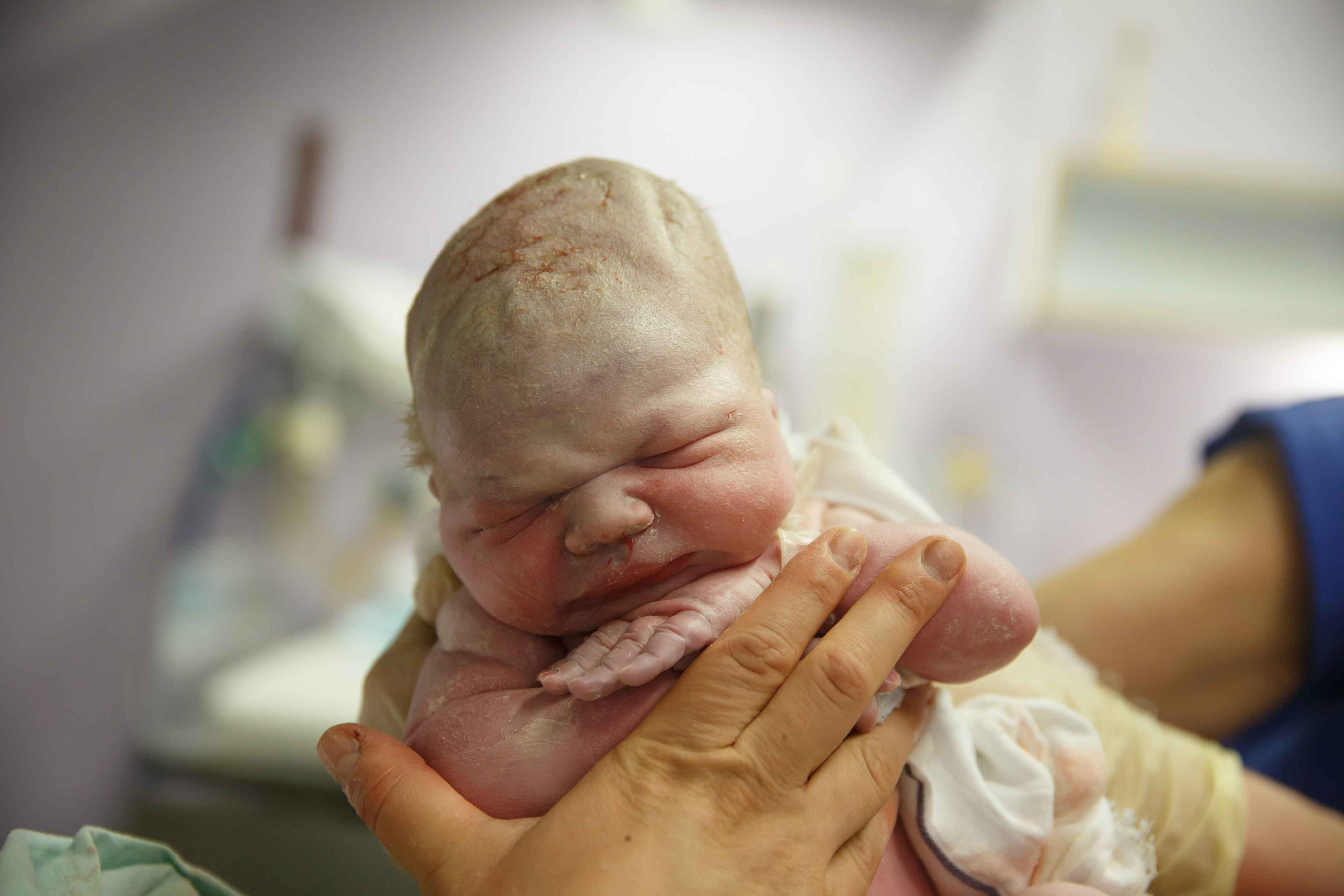 早产三斤多的婴儿图片图片