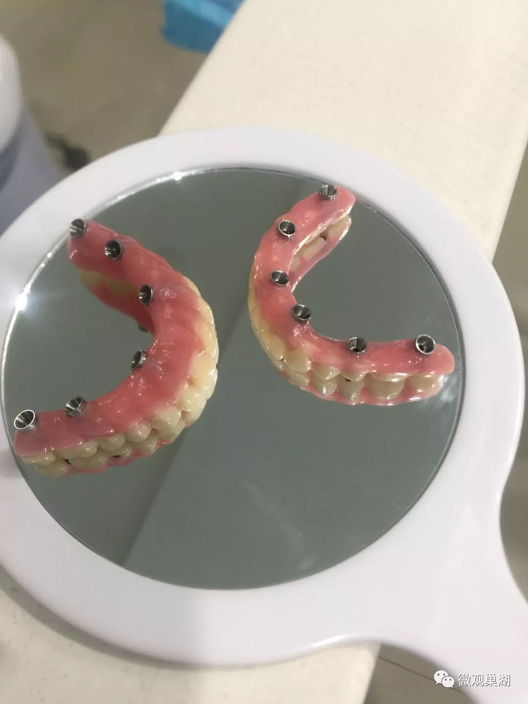 "戴假牙实在太麻烦,戴在嘴里小心翼翼,生怕不留神蹦出来,惹人笑话;每