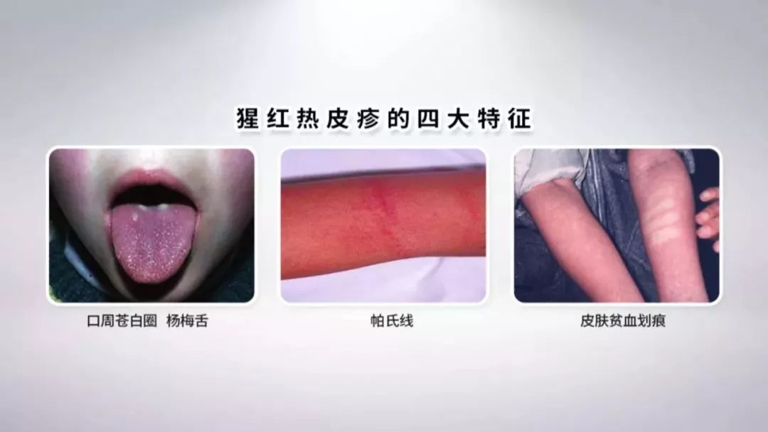 杨梅舌 来自搜狐网