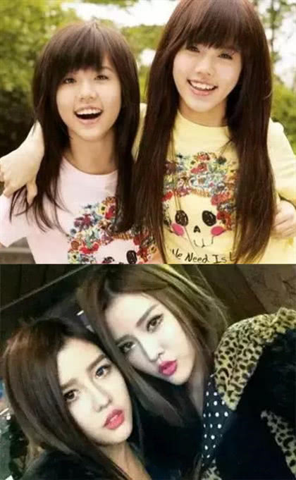 by2miko晒脸大片红斑肿胀不堪网友回复整容后遗症