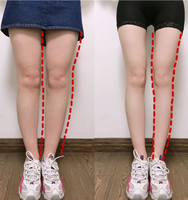 夏季必备黑科技珂宣尼睡眠闪电裤燃脂美肤降温驱蚊一条