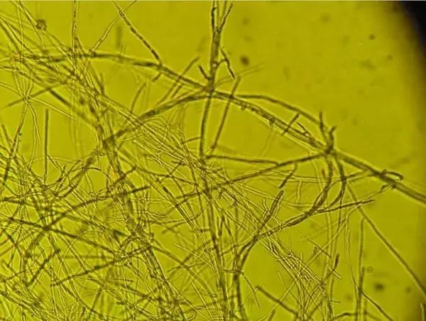 的天花板,墙与地板,配水管的黑色霉菌, 几乎为该菌或枝孢霉