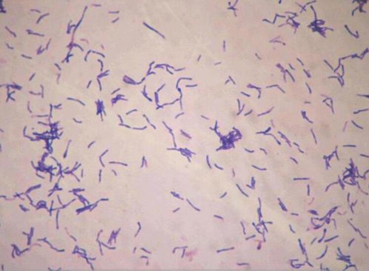 放线菌菌落颜色图片