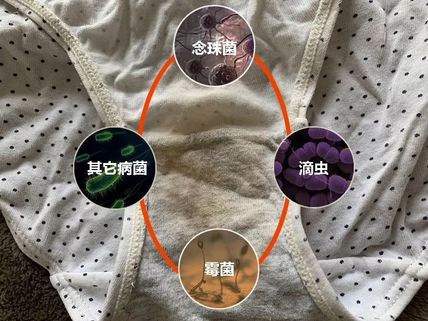 内裤裆部细菌的最爱而这些沉积下来的分泌物恰恰是越积越多之后导致