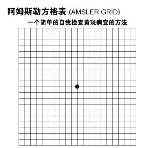 眼底自查图图片