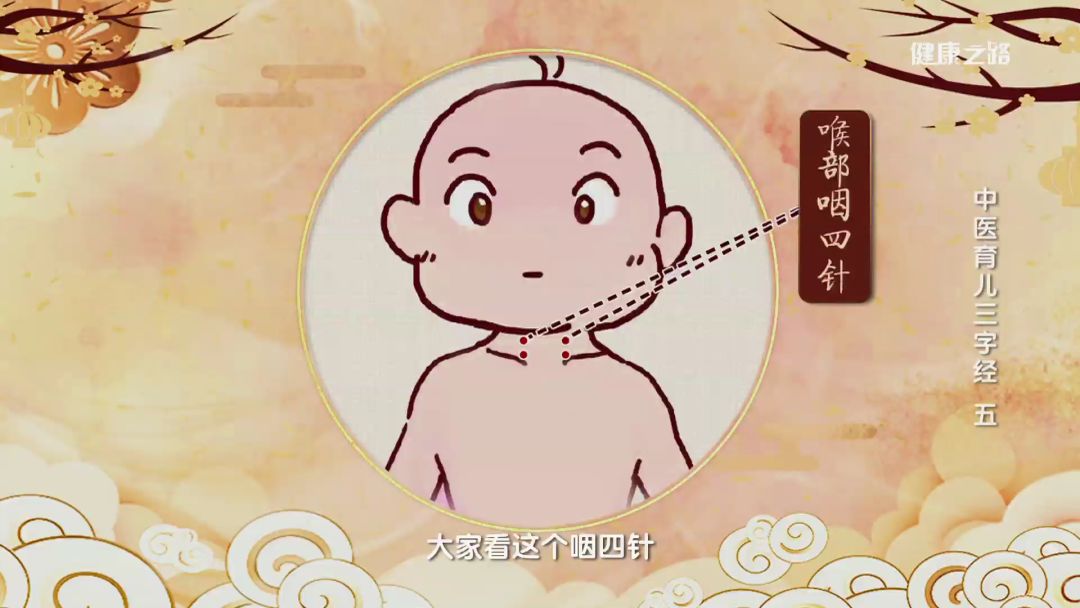 5到1厘米的距离,上下一共四针,贴上揿针后要自己按揉,按揉到有酸麻