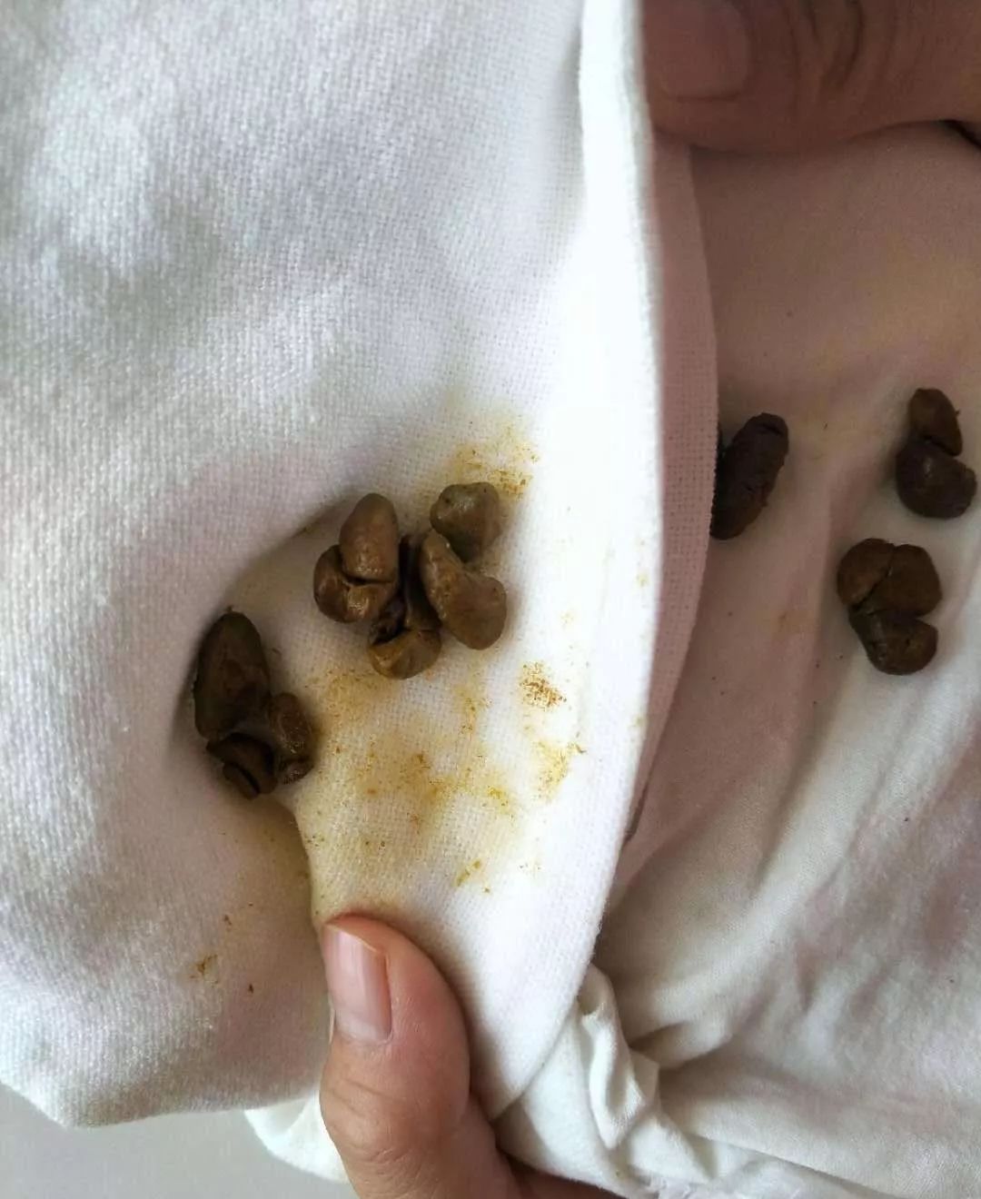 表情痛苦,并且排出的便便干燥,坚硬,像一粒一粒小硬球(像羊屎)的话