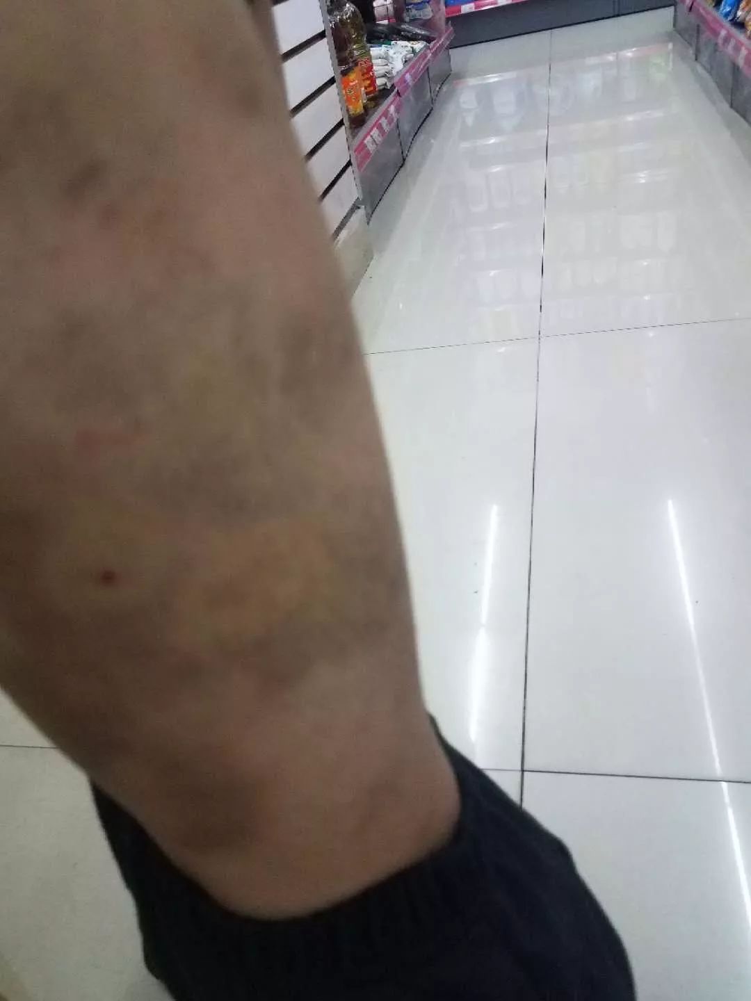 广东一名7岁女童被打到重伤休克小区邻居义愤填膺肯定是她母亲下的