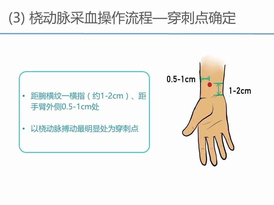 ppt资源动脉采血临床操作指南