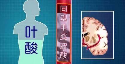 体检查出腔隙性脑梗是脑梗死吗专家提示五大危险因素需早控