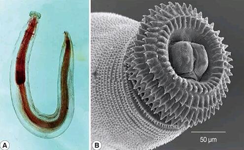 那些人体上的寄生虫能钻遍每一个洞