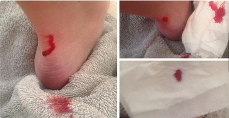 一贴瞬间时髦有型隐形拯救磨脚破皮实力让你足够魅力