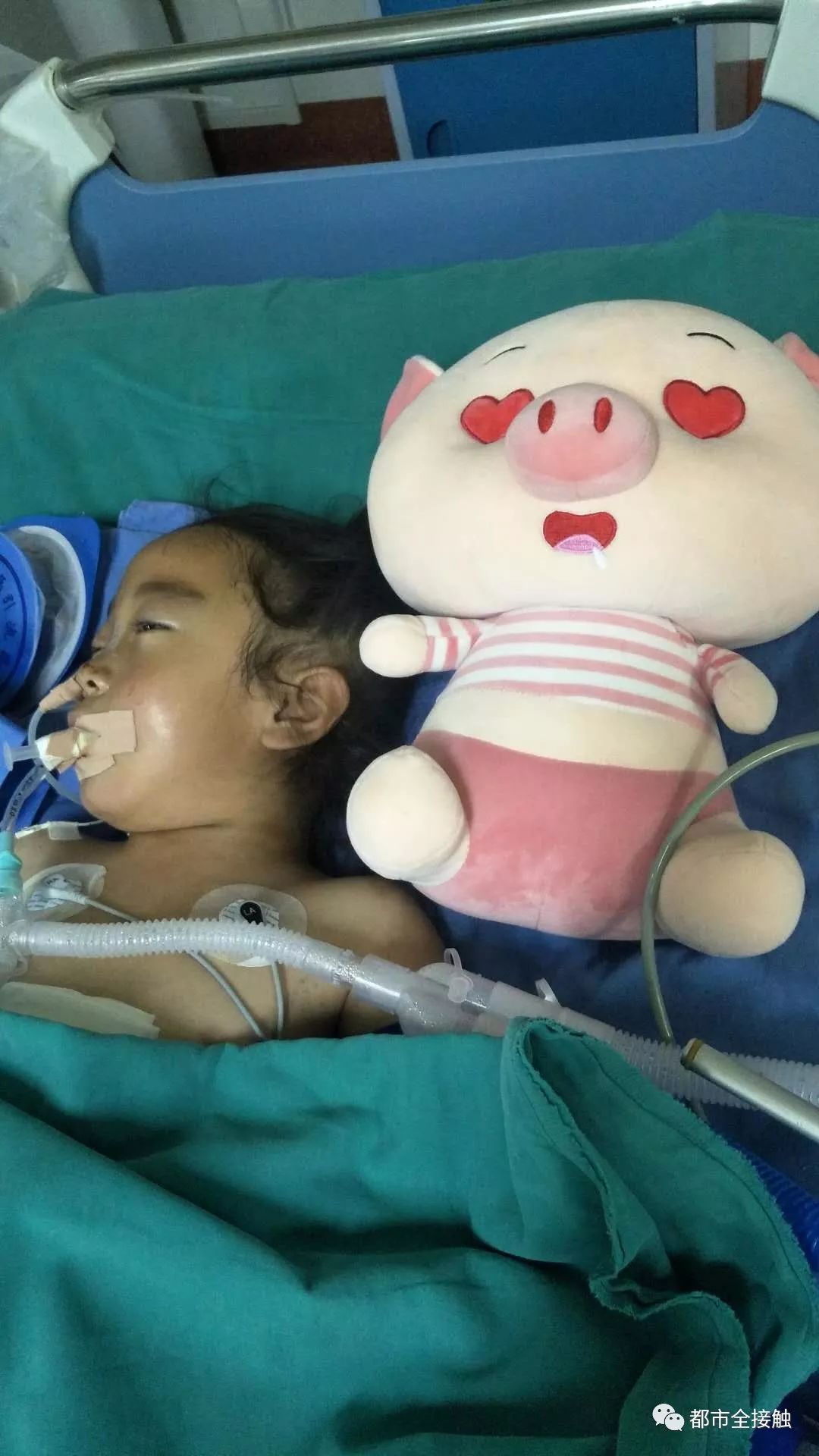 小馨源生命体征稳定后,还需要做第二次手术明天,也就是下周一《都市全