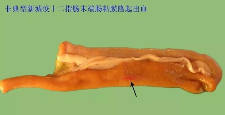 非典型新城疫两个盲肠之间回肠粘膜隆起出血从十二指肠的末端向下继续