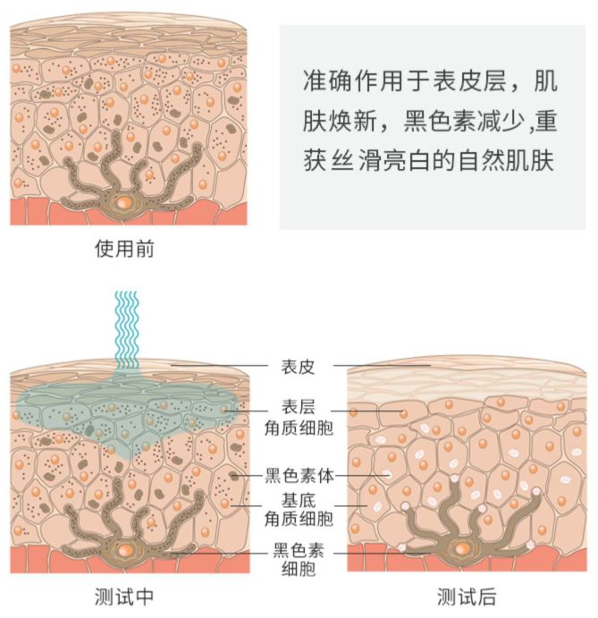 加速表皮的新陈代谢,排出多余的黑色素,新生的皮肤更加白皙,平滑